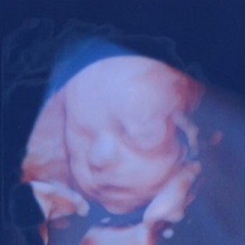 Unique Ultrasound - Loved that the accept walk ins, the lady that helped us was so sweet! - Diagnostic Imaging Near Me - Temecula, California