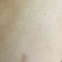 Photo of Seaside Dermatology & Skin Cancer Center