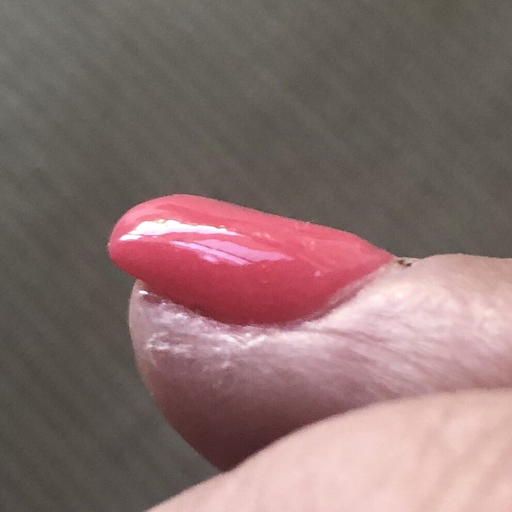 Paradise Salon - Nail is malformed - Nail Salons Near Me - Corte Madera, California Paradise Salon - Nail is malformed - Nail Salons Near Me - Corte Madera, California