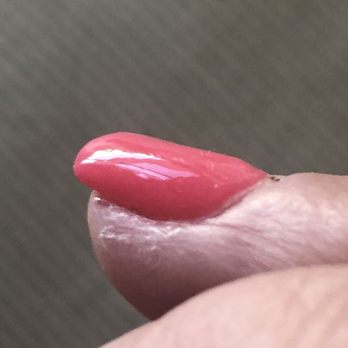 Paradise Salon - Nail is malformed - Nail Salons Near Me - Corte Madera, California Paradise Salon - Nail is malformed - Nail Salons Near Me - Corte Madera, California