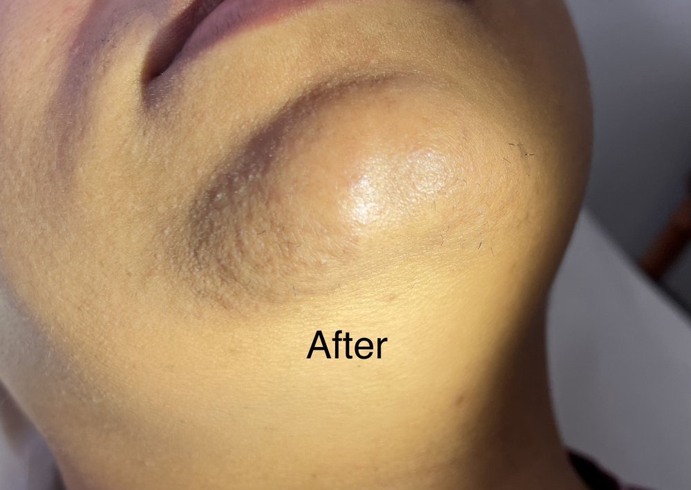 Electrolysis 2000 Logo