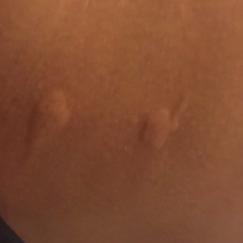 Best Western Gregory Hotel - STAY AWAY! Dirty water! NO HEAT! BEDBUGS! - Hotels Near Me - Brooklyn, New York Best Western Gregory Hotel - STAY AWAY! Dirty water! NO HEAT! BEDBUGS! - Hotels Near Me - Brooklyn, New York