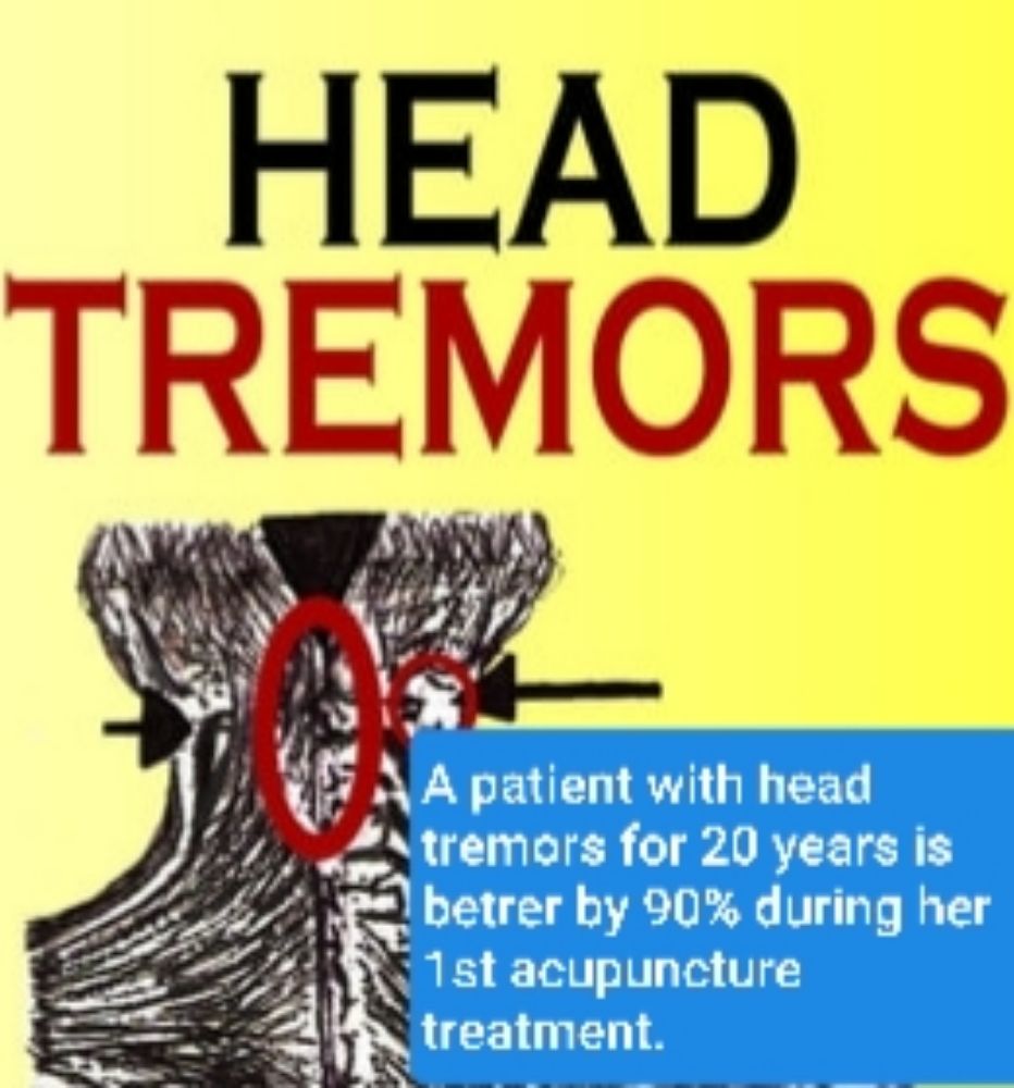 DENG ACUPUNCTURE AND HERB 449 Photos & 44 Reviews 4220 Rocklin Rd