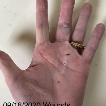 Swift Institute Hand Therapy - Lots of therapy!!! - Occupational Therapy Near Me - Reno, Nevada Swift Institute Hand Therapy - Lots of therapy!!! - Occupational Therapy Near Me - Reno, Nevada