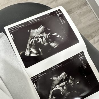 Macarthur OB/GYN - Ultrasound Picture - Obstetricians & Gynecologists Near Me - Euless, Texas
