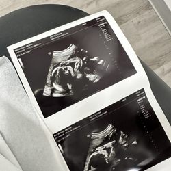Macarthur OB/GYN - Ultrasound Picture