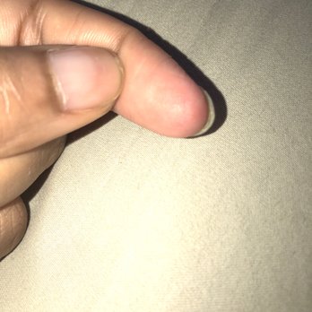 Midtown Nail - July 2019-Infection - Nail Salons Near Me - Atlanta, Georgia Midtown Nail - July 2019-Infection - Nail Salons Near Me - Atlanta, Georgia