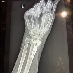 Orthopedic Associates of Central Texas - This is why I'm here.