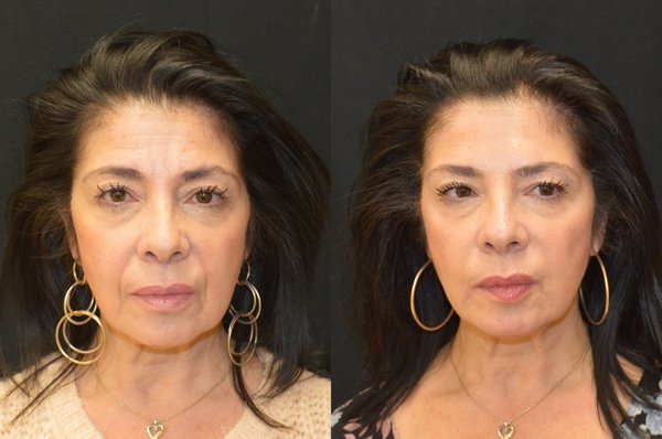 Baroody Plastic Surgery by null