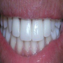 Comfortable Dentistry 4U