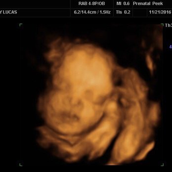 New Direction Fertility Centers - Endocrinologists Near Me - Gilbert, Arizona New Direction Fertility Centers - Endocrinologists Near Me - Gilbert, Arizona
