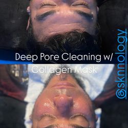 Deep Pore Cleaning