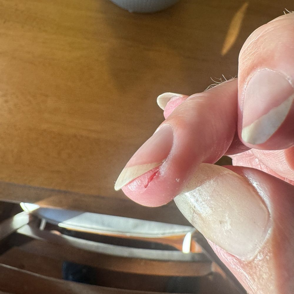 Sawed finger from nail board. Sawed finger from nail board.