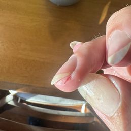 Sawed finger from nail board. Sawed finger from nail board.