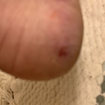 Happy Nails and Tanning - My super bleeding heel. - Nail Salons Near Me - Ormond Beach, Florida