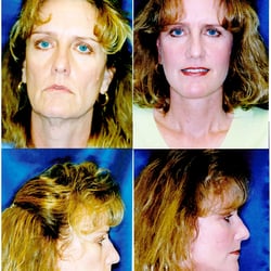 Keller Plastic Surgery