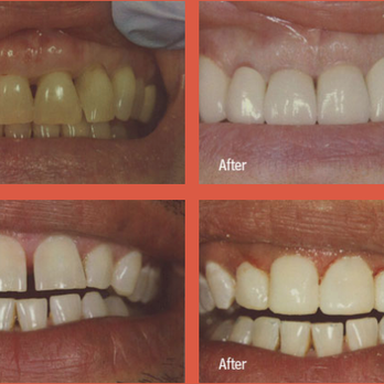 Harry Satin, DDS - General Dentistry Near Me - Hewlett, New York Harry Satin, DDS - General Dentistry Near Me - Hewlett, New York