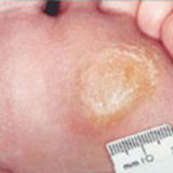Pear Tree Podiatry