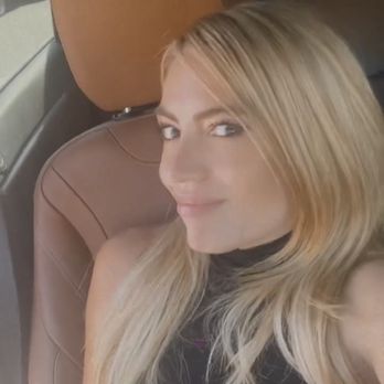 Skin Sirens Aesthetics - After - Aestheticians Near Me - Agoura Hills, California Skin Sirens Aesthetics - After - Aestheticians Near Me - Agoura Hills, California