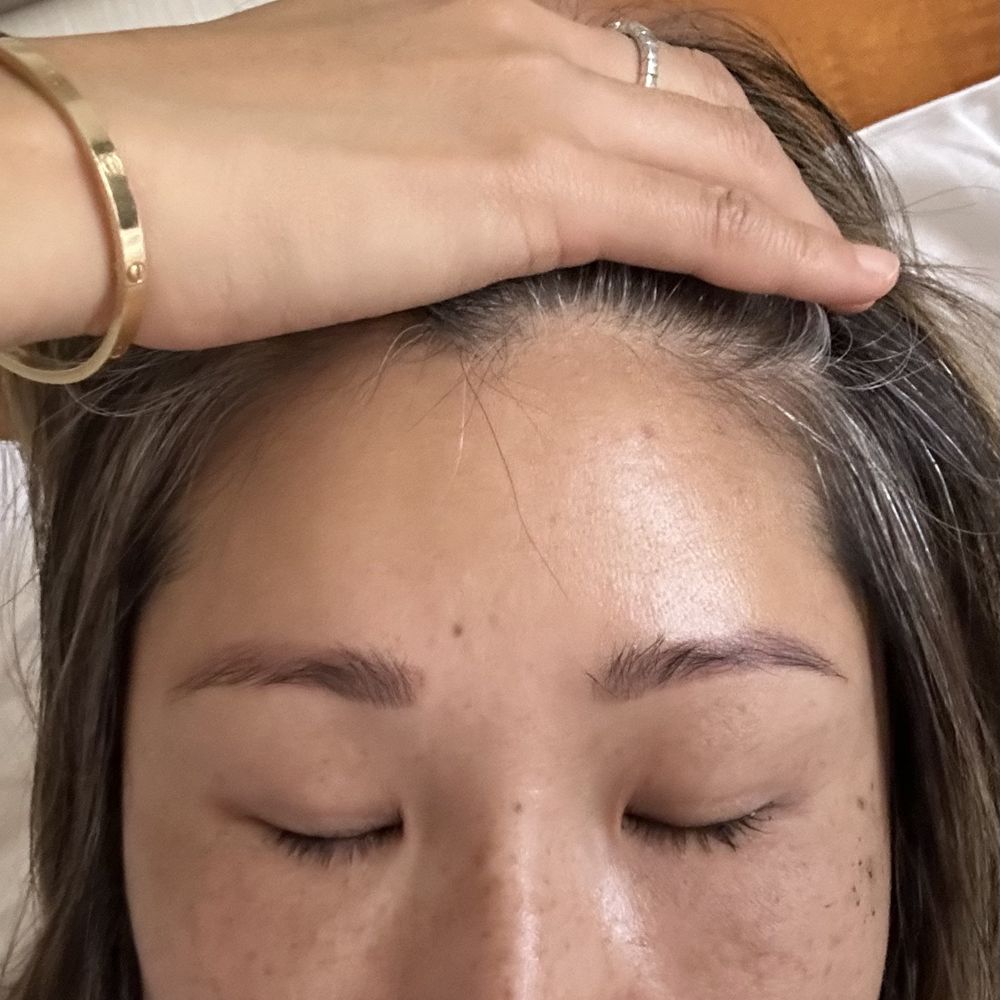 Before picture with pigmentation and inner brows (middle) both going right.
