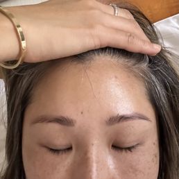 Before picture with pigmentation and inner brows (middle) both going right. Before picture with pigmentation and inner brows (middle) both going right.