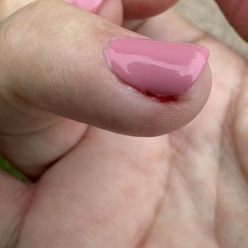 Del Mar Nails and Spa - painful manicure - Nail Salons Near Me - Del Mar, California Del Mar Nails and Spa - painful manicure - Nail Salons Near Me - Del Mar, California