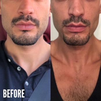 Gabbay Plastic Surgery - Cosmetic Surgeons Near Me - Beverly Hills, California