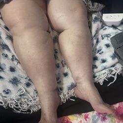 Garnet Health Medical Center - This was her condition when they denied treatment and tried to send her home.