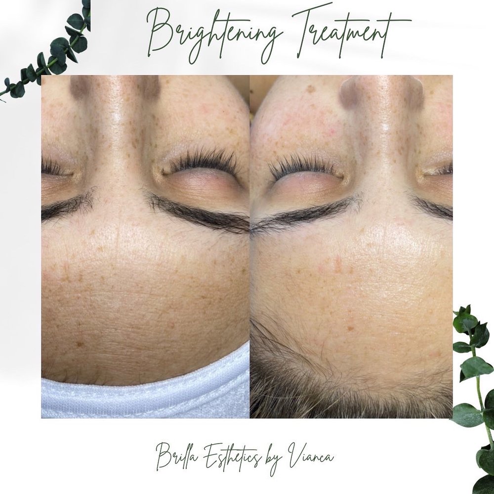 Brilla Esthetics  Logo