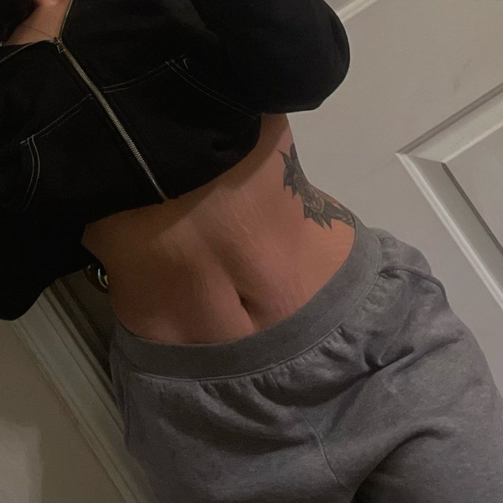 Babes Esthetics - 9 months in progress - Day Spas Near Me - Reno, Nevada