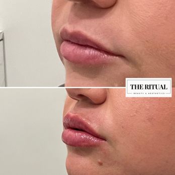 The Ritual Aesthetics - Medical Spas Near Me - Castle Rock, Colorado The Ritual Aesthetics - Medical Spas Near Me - Castle Rock, Colorado