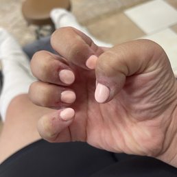 Uneven nail polish.
