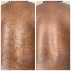 Waxstrology - Men's full back - before/after