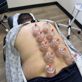 Mina Iskander -Chiropractor - Chiropractors Near Me - Orange, California Mina Iskander -Chiropractor - Chiropractors Near Me - Orange, California