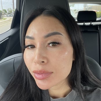 Aesthetic Trends Medspa - Day 3 after session 2, face peeling - Medical Spas Near Me - Garden Grove, California Aesthetic Trends Medspa - Day 3 after session 2, face peeling - Medical Spas Near Me - Garden Grove, California