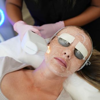 LaserAway - Laser Hair Removal Near Me - Meridian, Idaho