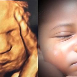 Chubby Cheeks 3D/4D Ultrasound Studio of Amarillo