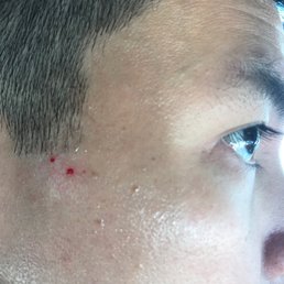 Nicks and cuts... too early in the morning? Remind your barber to be careful. Nicks and cuts... too early in the morning? Remind your barber to be careful.