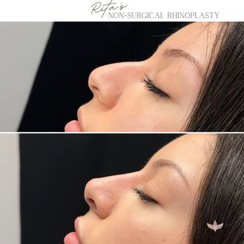 Lazer Lounge - Laser Hair Removal Near Me - Studio City, California Lazer Lounge - Laser Hair Removal Near Me - Studio City, California
