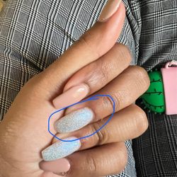 Venus Nails & Spa - Bulky misshapen nail