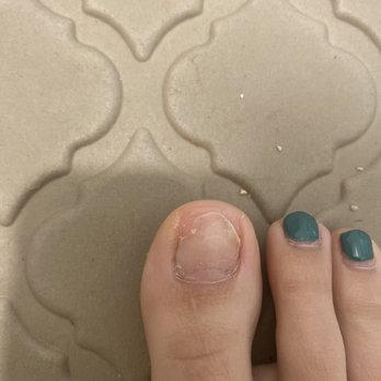 Esta Nail Spa - Toe nail fungus - Nail Salons Near Me - Menifee, California Esta Nail Spa - Toe nail fungus - Nail Salons Near Me - Menifee, California