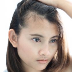 MD Remedy - Pause the hair loss. You can try PRP before it's too late.