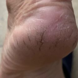 Nails Loft - Well see for yourself what $36 callous removal gets you in this place