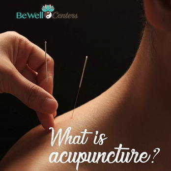 Raviva Healing Center - Acupuncture Near Me - Sunrise, Florida Raviva Healing Center - Acupuncture Near Me - Sunrise, Florida