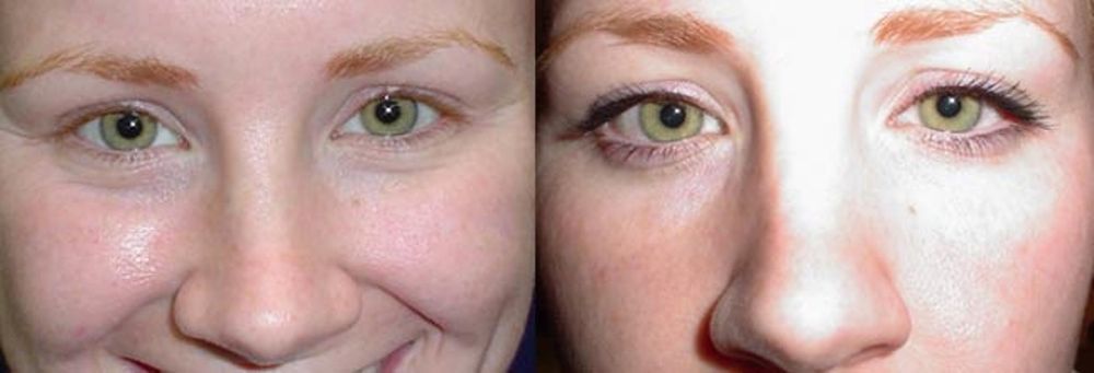 Pigmenta Permanent Cosmetics 33 - Boston Permanent Makeup Pigmenta Permanent Cosmetics 33 - Boston Permanent Makeup