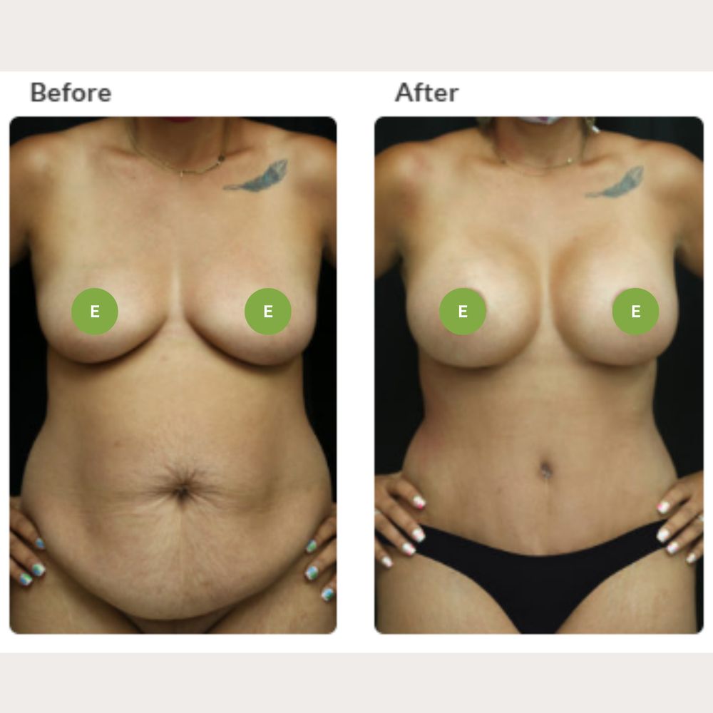 Eberbach Plastic Surgery - A Division of IBI Healthcare