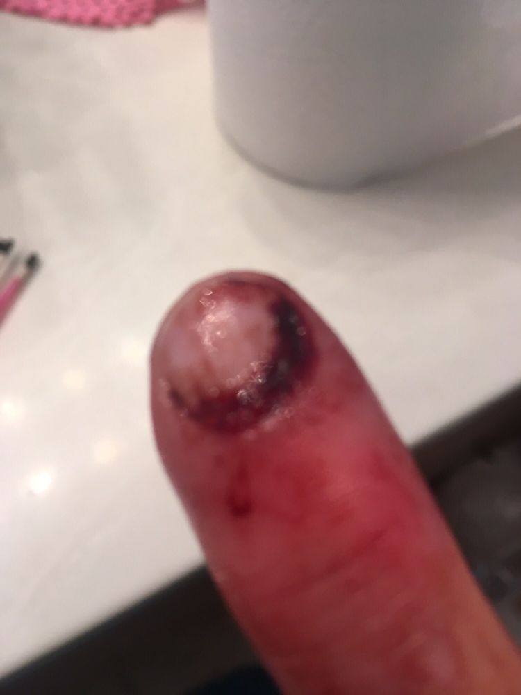 Northwest Medical Center - Bentonville - patient advocate in Bentonville, AR