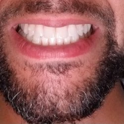 Bebrin W & C Cugine DMD