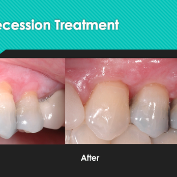 Periolife - Periodontists Near Me - Keller, Texas Periolife - Periodontists Near Me - Keller, Texas