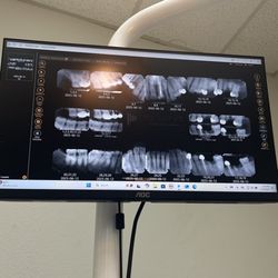 Forest Family Dentistry - My X-Yays - Good lord that's a lot of work. lol